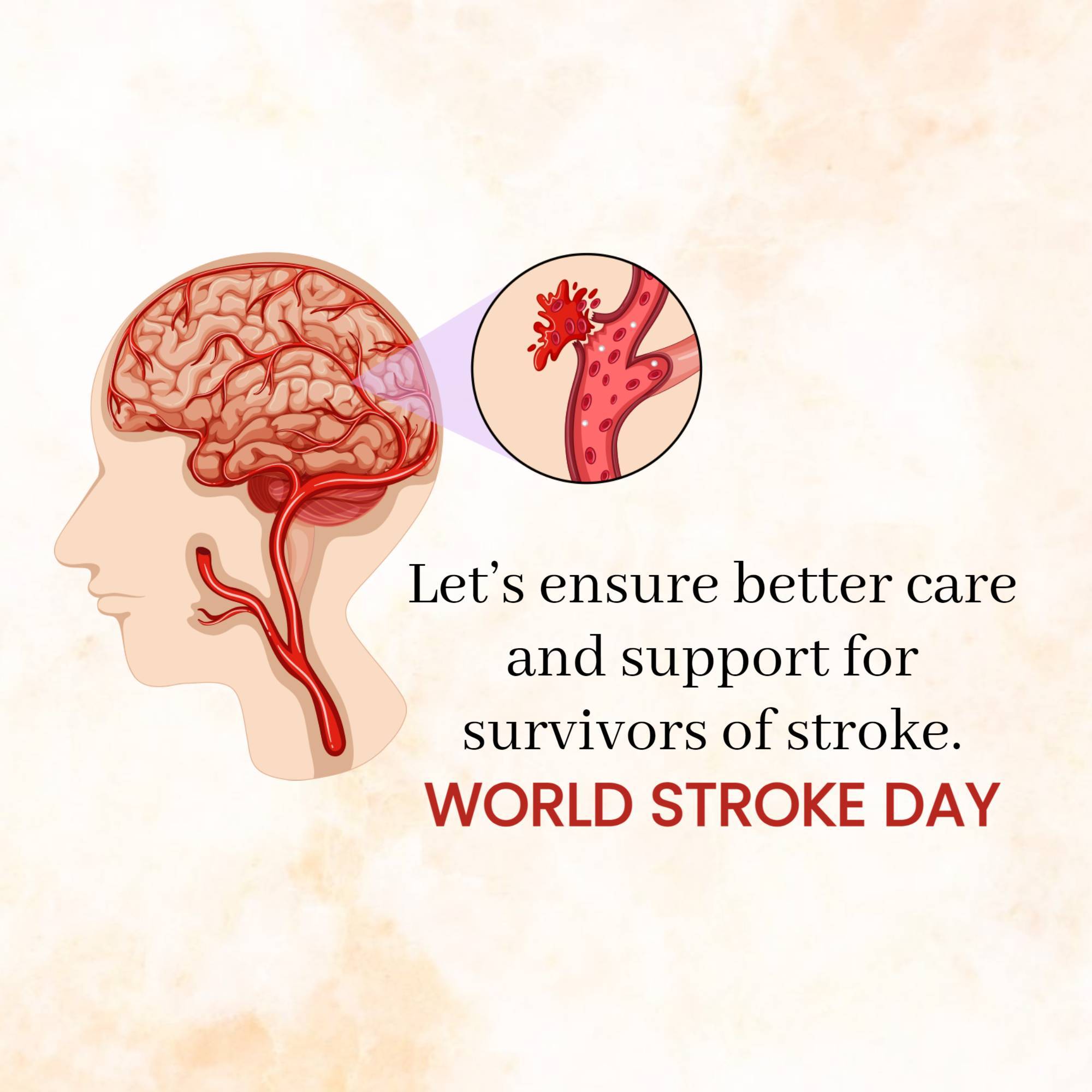 World Stroke Day
