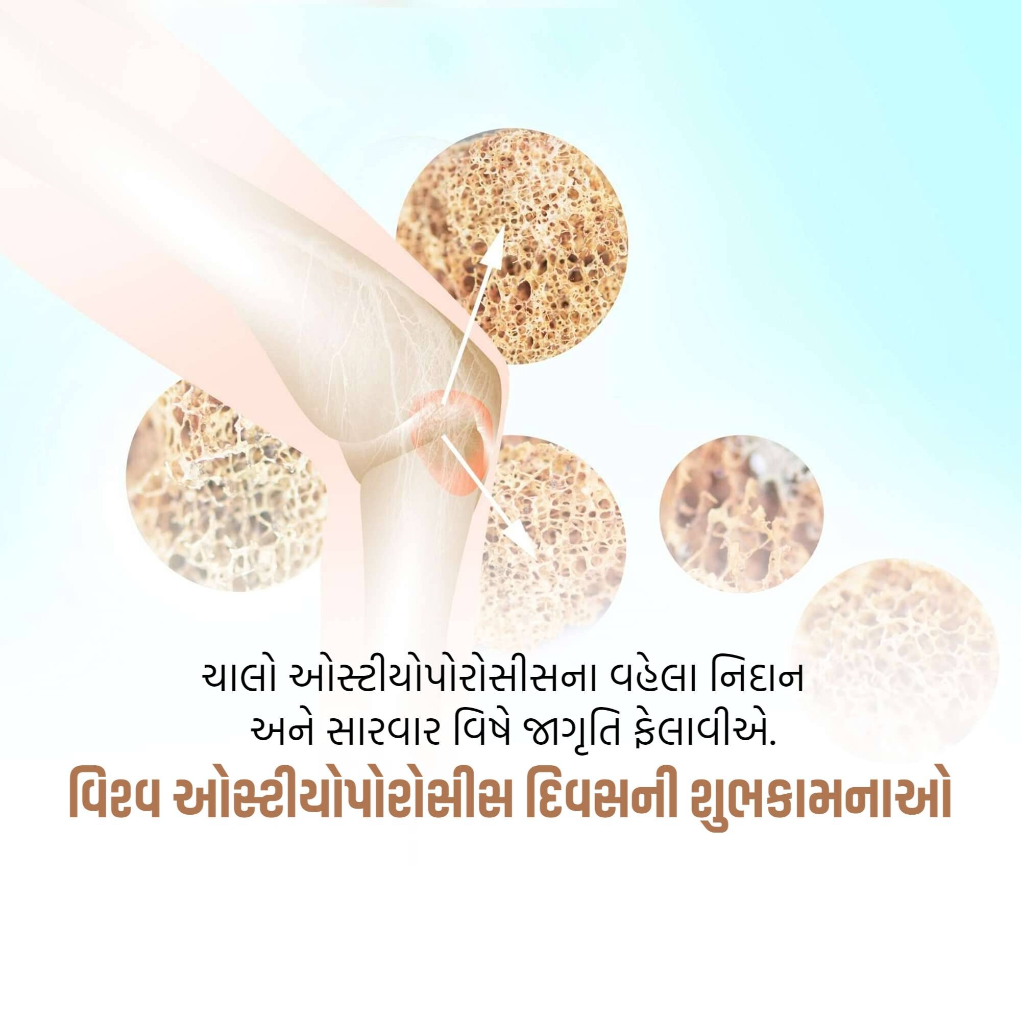World Osteoporosis Day