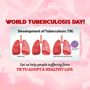 World Tuberculosis (TB) Day