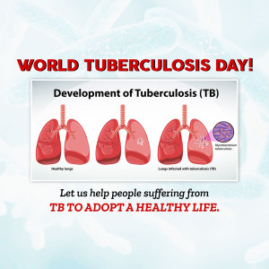 World Tuberculosis (TB) Day
