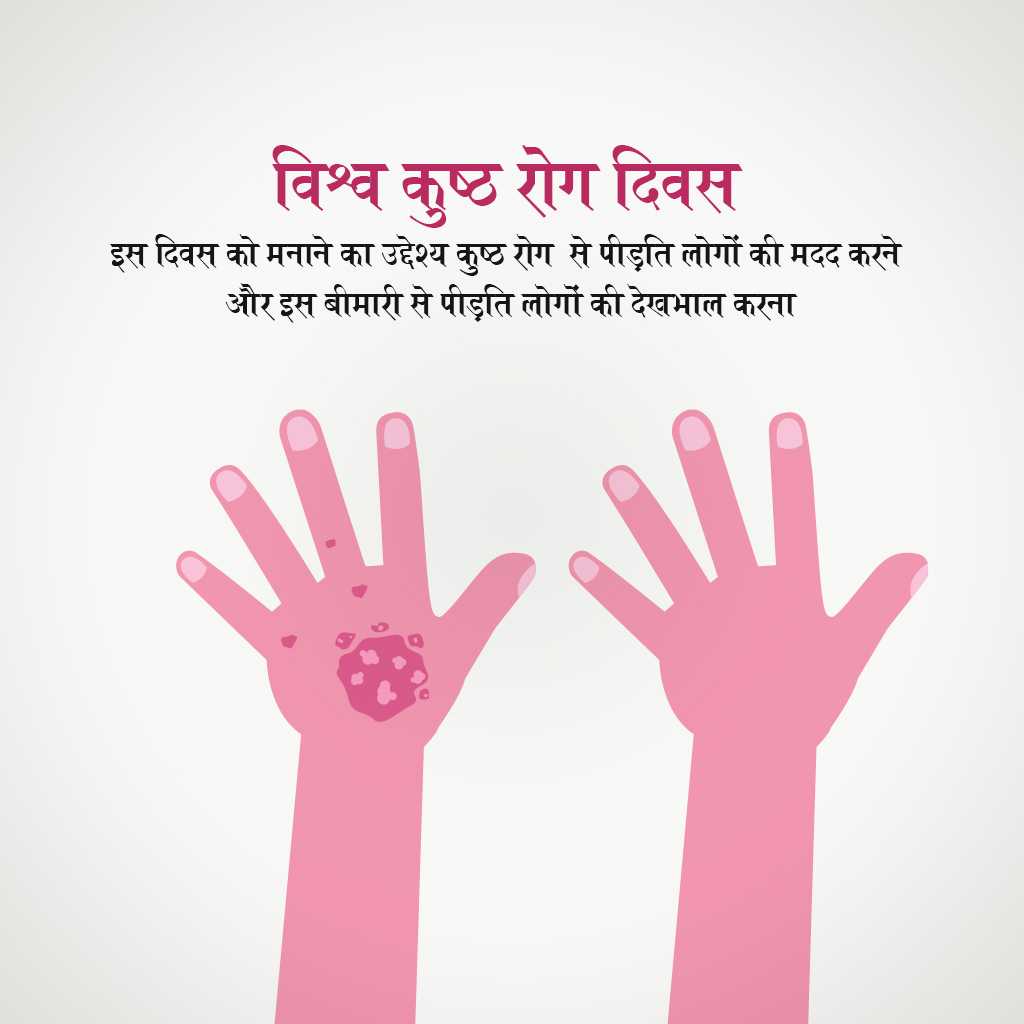 World Leprosy Day