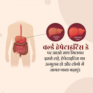 World Hepatitis Day